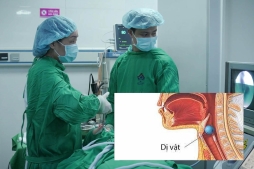 Cảnh báo nguy cơ thường gặp gây viêm mũi, cản trở đường thở ở trẻ