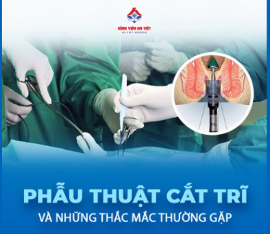 Phẫu thuật cắt trĩ và những thắc mắc thường gặp