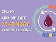 Chu kỳ kinh nguyệt 35-40 ngày có đáng lo không, khi nào cần đi khám bác sĩ? 