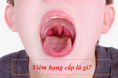 Bệnh viêm họng hạt cấp tính- Nguyên nhân, triệu chứng và cách phòng ngừa bệnh