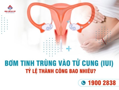 Bơm tinh trùng vào tử cung (IUI) tỷ lệ thành công bao nhiêu?