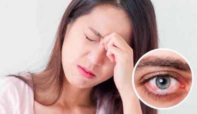 Bị đau mắt đỏ cần xử trí thế nào để nhanh khỏi