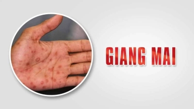 Bệnh giang mai có triệu chứng gì, nguy hiểm thế nào?