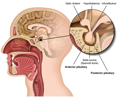 Những dấu hiệu cảnh báo u tuyến yên