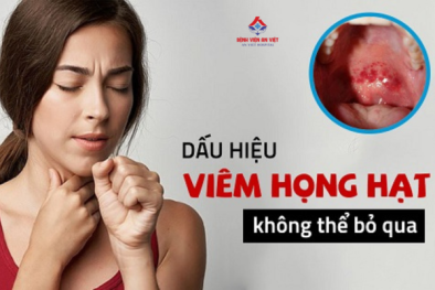 Viêm họng hạt: Dấu hiệu và cách điều trị hiệu quả