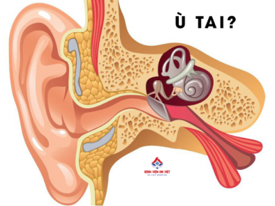 Ù tai do nguyên nhân gì và khi nào cần đi khám?