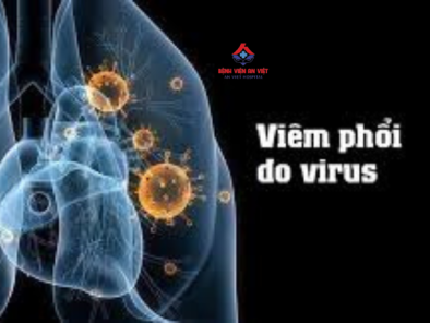 Viêm phổi do virus: Triệu chứng, chẩn đoán và cách điều trị