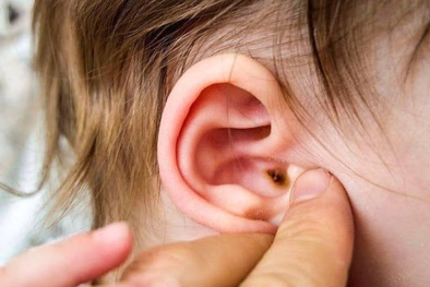 Viêm tai ngoài: Nguyên nhân, triệu chứng và biến chứng