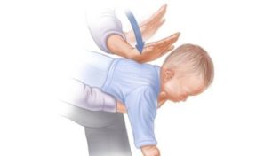 Hóc dị vật đường thở: Những điều cần biết