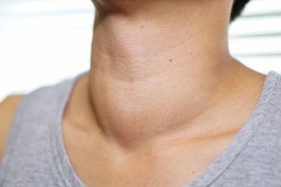 Cường giáp có dấu hiệu gì, nguy hiểm không?