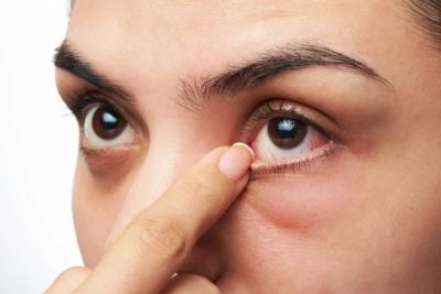 Những dấu hiệu về thị giác cảnh báo bệnh tiểu đường