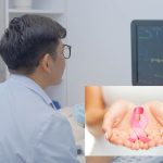 Ưu tiên tầm soát bệnh khác mà bỏ quên bệnh ung thư thường gặp ở phụ nữ