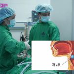 Cảnh báo nguy cơ thường gặp gây viêm mũi, cản trở đường thở ở trẻ