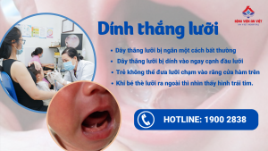 Treatment of tongue-tie in young children