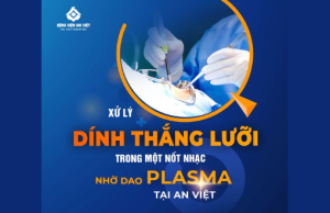 Dính thắng lưỡi khiến trẻ chậm nói, nói ngọng – Cắt dính thắng lưỡi càng sớm càng tốt tránh ảnh hưởng về sau..