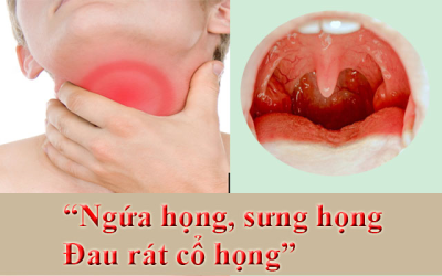Cách chữa biến chứng viêm họng hạt tránh những nguy hiểm