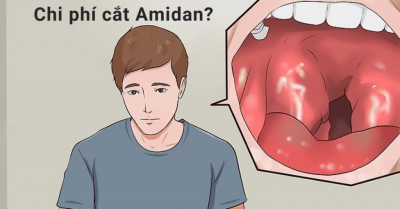 Cắt amidan tốn bao nhiêu tiền? có được dùng bảo hiểm y tế hay không?