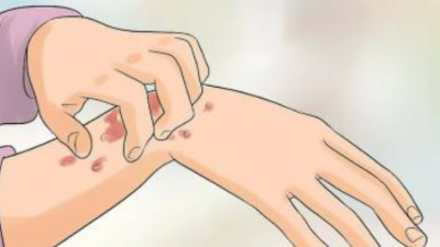 Bác sĩ chuyên khoa nói về loại bệnh xã hội nguy hiểm