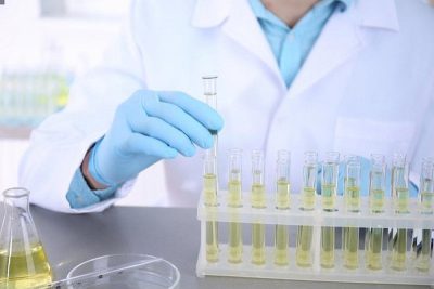 Unusual signs of urine you need to see a doctor immediately