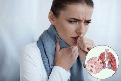 Những dấu hiệu cảnh báo sớm ung thư – có thể bạn chưa biết