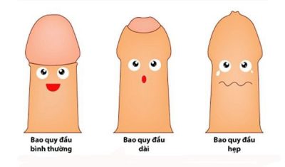 Địa điểm khám và điều trị hẹp bao quy đầu uy tín ở Hà Nội