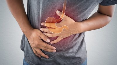 Trào ngược dạ dày là gì, có triệu chứng ra sao?