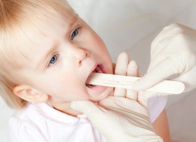 Chuyên gia nói về những biến chứng nguy hiểm viêm tai giữa ở trẻ nhỏ