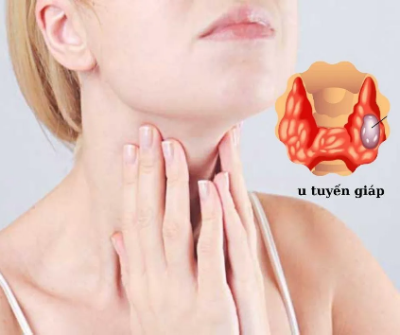 3 căn bệnh ung thư thường gặp ở phụ nữ