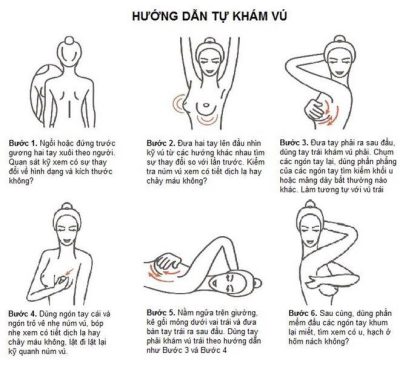 Cách phát hiện sớm ung thư vú tại nhà chị em có thể thực hiện