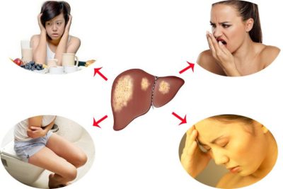 3 điều bất thường cảnh báo gan của bạn đang có vấn đề