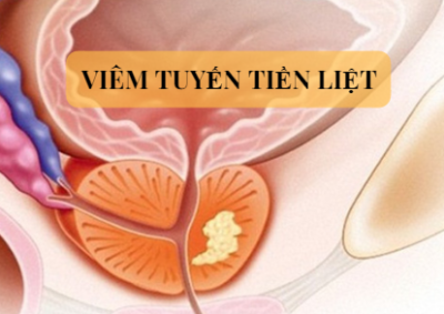Viêm tuyến tiền liệt có nguy hiểm hay không?
