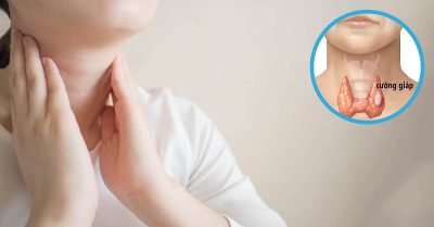 Hội chứng cường giáp có nguy hiểm hay không?