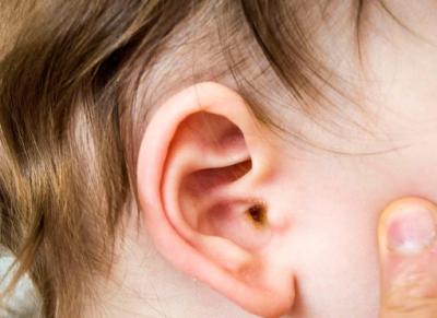 Viêm tai giữa – bệnh lý phổ biến ở trẻ em