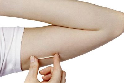 Cấy que tránh thai có ảnh hưởng đến chức năng sinh sản không?