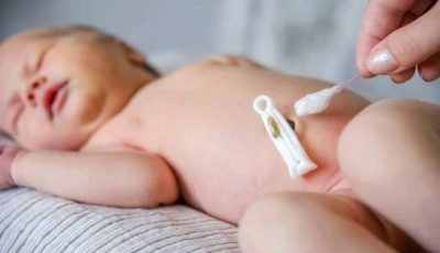 Căn bệnh cực nguy hiểm ở trẻ sơ sinh