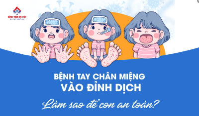 Dấu hiệu nhận biết sớm trẻ mắc bệnh tay chân miệng