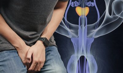 U tinh hoàn nặng gần 1kg của người đàn ông 71 tuổi