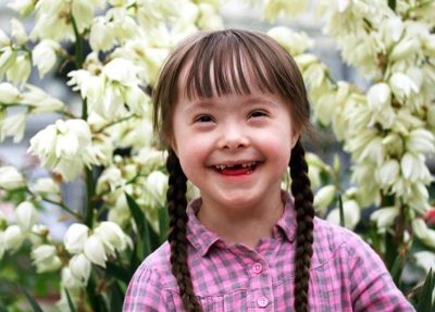 Bé gái vừa chào đời mắc hội chứng siêu nữ