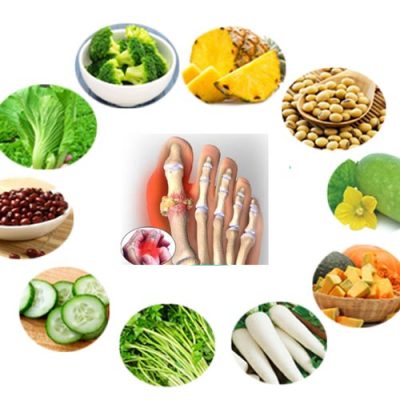 Người bị bệnh gout không nên bỏ qua bài viết này!