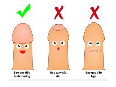 Bệnh viện An Việt – Địa chỉ cắt bao quy đầu uy tín ở Hà Nội