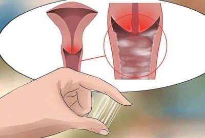 Những dấu hiệu nào cảnh báo bệnh phụ khoa