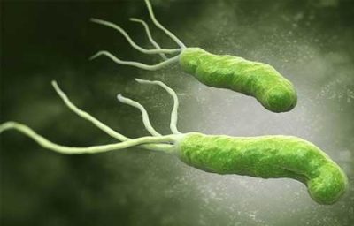 Vi khuẩn HP: Khi nào cần điều trị?