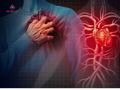  7 dấu hiệu phát hiện bệnh tim mạch sớm: Chớ chủ quan