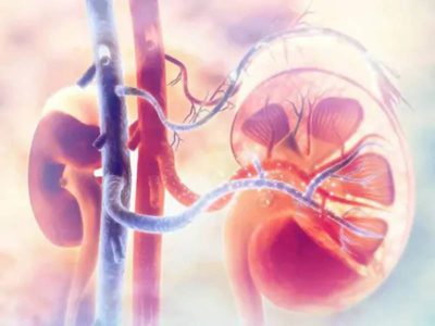 Thận ứ nước độ 3 có nguy hiểm không?