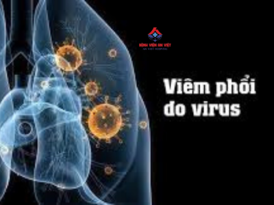 Viêm phổi do virus: Triệu chứng, chẩn đoán và cách điều trị