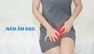 Nấm âm đạo: Tình trạng phổ biến ở nữ giới