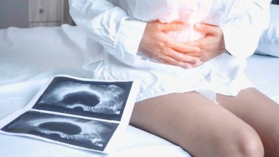 U nang buồng trứng là gì, có nguy hiểm không?