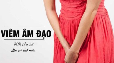 Viêm âm đạo: Bệnh phụ khoa thường gặp và không thể xem nhẹ