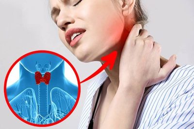 Bướu Tuyến Giáp: Khi Nào Lành Tính, Khi Nào Cần Lo?