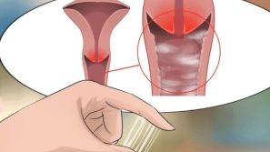 Viêm Nhiễm Phụ Khoa Tái Đi Tái Lại – Cách Điều Trị Dứt Điểm?